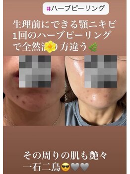 リツイート(ReTweet)/