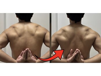 スキャプレーン 米子(SCAPLANE)/BEFORE AFTER事例