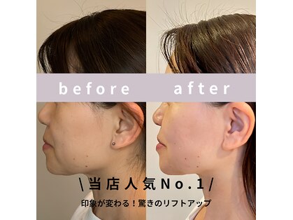 アオダモの写真