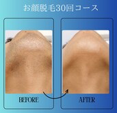 ハイリー(Hily)