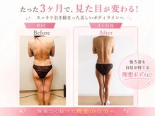 ヨサパーク ハーブメロディー 鈴鹿店(YOSA PARK)