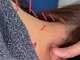 アオヤマ サロン ワイゼット(AOYAMA SALON YZ)の写真/【マッサージでは物足りない首肩こりに】攻める鍼灸×カイロ整体｜施術歴20年以上