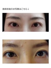 アロマスイーツ(AromaSweets)/まつげパーマ/パーマ/マツパ