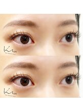 クレー(Klee)/シングルラッシュ