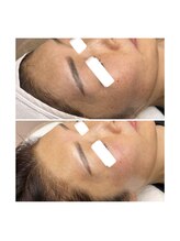 ホワイトワックス 京都四条烏丸(WHITE WAX)/お肌の透明感UP↑