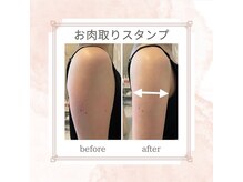 ウナ デ リンゴル 恵比寿店(UNA de Ringol)/ボディ痩身¥18,000