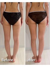 ヒールプラス(heal+)/真っ直ぐ美脚、ヒップアップも◎