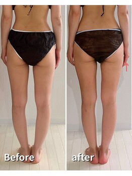 ヒールプラス(heal+)/真っ直ぐ美脚、ヒップアップも◎