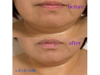 ターリア(THALIA)の写真