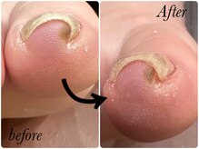 ゾゾ イリプレッセブル(ZOZO irreplaceable)