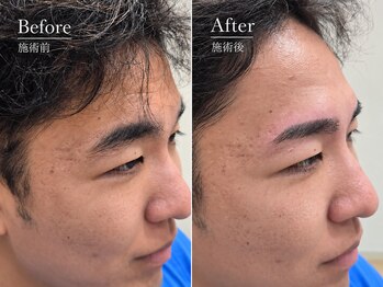 コア 習志野店(CORE)の写真/眉毛/眉毛サロン/アイブロウ/メンズ/メンズ眉毛/まゆげ/眉/眉サロン/メンズ眉毛サロン/アイブロウサロン/