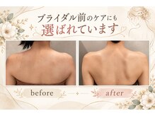 グレース(grace)