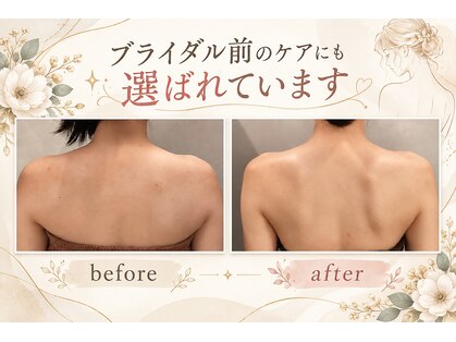 グレース(grace)の写真