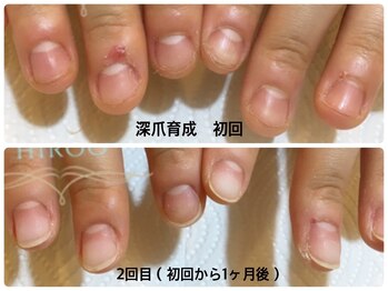 モアニヒロオ 広尾駅前店(MOANI Hiroo)/深爪育成