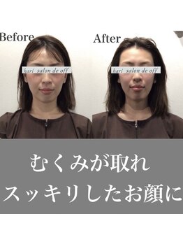 ハリサロンドオフ 心斎橋店(hari salon de off)/キュッと小顔に♪