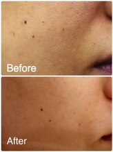 ファニービー 茨木店/Before→After