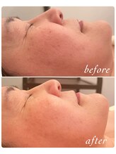 サロン ド ベル(salon.de.Belle)/陶肌トリートメント