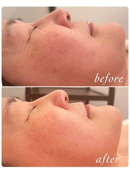 サロン ド ベル(salon.de.Belle)/陶肌トリートメント