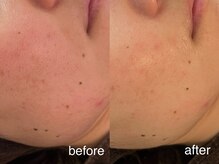 テオリア(TEORIA)/ちゅるんちゅるん♪