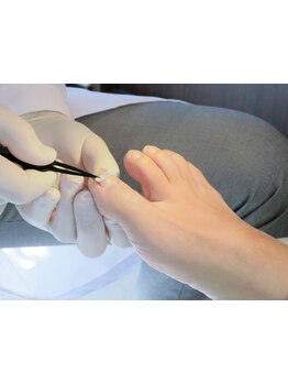 爪の悩みを解消できる（ケア含む）