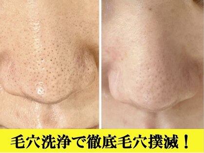 イリゼ(iriser)の写真
