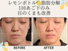 藍/レモンボトル＆プラズマ