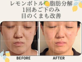 藍/レモンボトル＆プラズマ