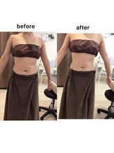 ジョワイユ(Joyeux)/腸の位置でお腹は変わる