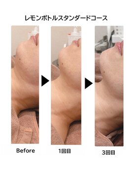 ラピス 新宿/レモンボトル