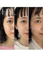 ロジ(loji)/ハリウッドブロウリフト