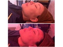 ココラボ(COCOLABO)の雰囲気（スッキリフェイスライン！特殊な熱でたるみケア）