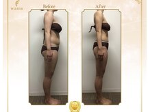 ラ メール(La mer)/ハイパーナイフ10回コース