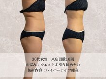 エクストリミティ 国立店(EXTREMITY)/お客様の変化