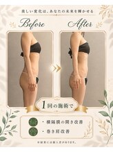 リンガ(Ringa)/1回で感じる姿勢の変化