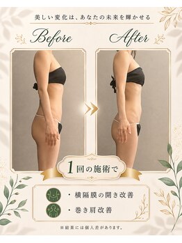 リンガ(Ringa)/1回で感じる姿勢の変化