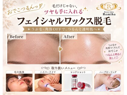 レミハ(Remiha)の写真