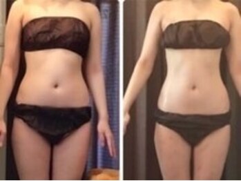 美容整体ウェリナ あま甚目寺院/小顔矯正/骨盤矯正/美脚サロン