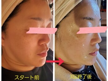 バンブー(bamboo)/シリカ