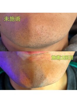 ロッソ ウオモ(ROSSO Uomo)/