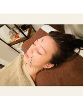 プラス(APLUS)/施術風景