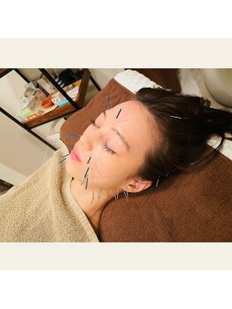 プラス(APLUS)/施術風景