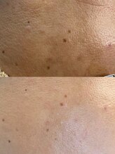 ナチュライズ(NatuRise)/くすみ、シミケア、美白