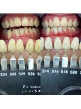 トウキョウスワーズ 池袋店(TOKYO SWRS)/#ホワイトニング #池袋 #渋谷
