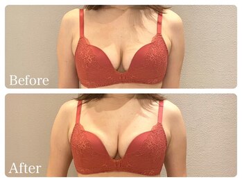 ククナ(KUKUNA)/*バストアップマッサージ*