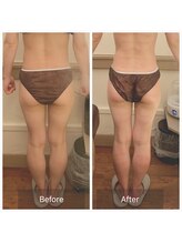 カルナ(carna)/《2か月計4回》2週間に1回