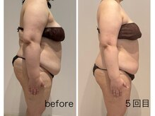 アピロスビアンティ(APEIROS BIANTY)/パワーレメディー