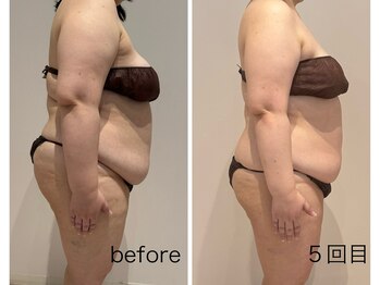 アピロスビアンティ(APEIROS BIANTY)/パワーレメディー