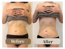 アムール(Amour)/上半身痩せ｜50代女性