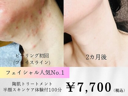 アルバ スキンガーデン(ALBAスキンガーデン)の写真