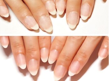 ネイルサロン アテナ(Athena)の写真/手元が綺麗に見えるネイルを叶えたい方にこそ、ぜひ体験していただきたいケアです。